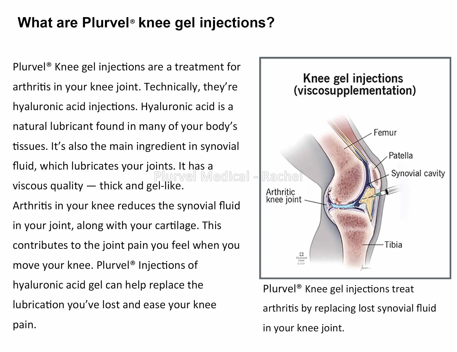 Non-Crosslinked HA Knee Joint Injection 3cc — Orthopedic HA product image 3