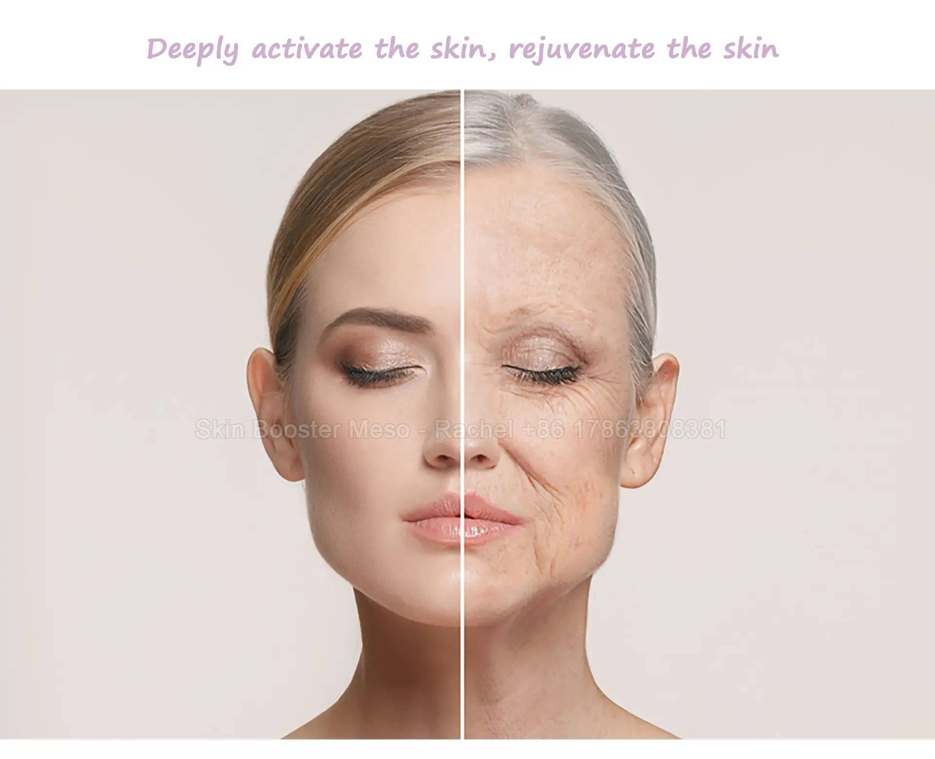 Skin Booster Premium Meso 5ml × 5 — Premium Meso / Skin Booster product image 2