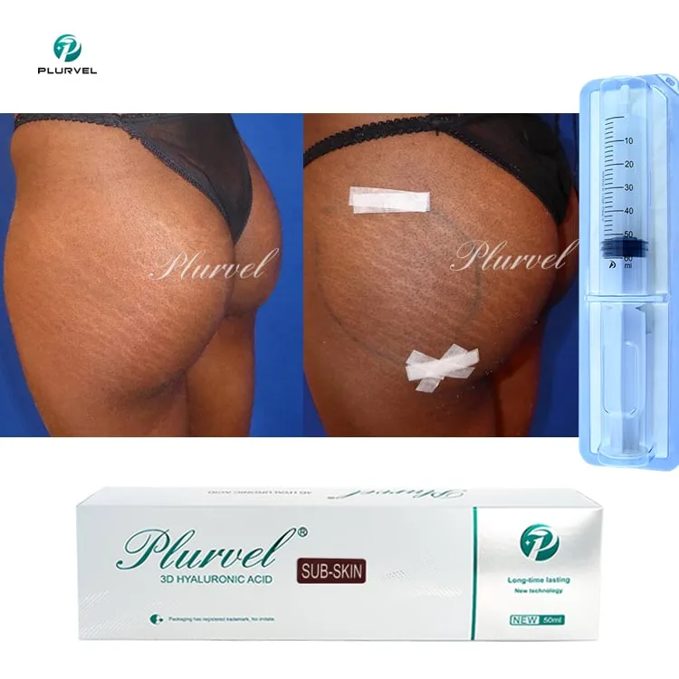 Medical Body Filler 50cc — Body HA product image 1
