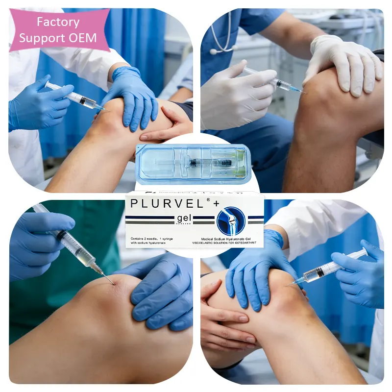 Non-Crosslinked Hyaluronic Acid Intra-Articular Injection for… — Orthopedic HA